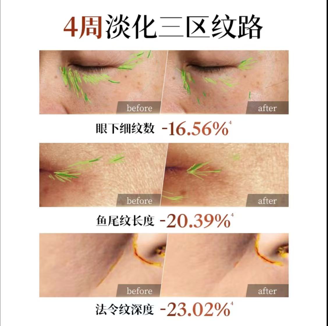 AAA  【韦雪推荐】SkinLane肌侣大师面膜紧致提拉淡化贵妇油乳灌肤膜